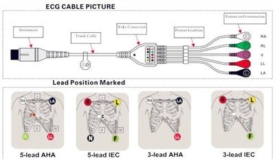 Hvordan koble EKG-kabel med ledninger til en pasientmonitor på riktig måte?